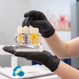 a dentist holding a dental implant model