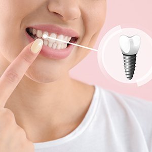 a dental implant patient pointing to her teeth