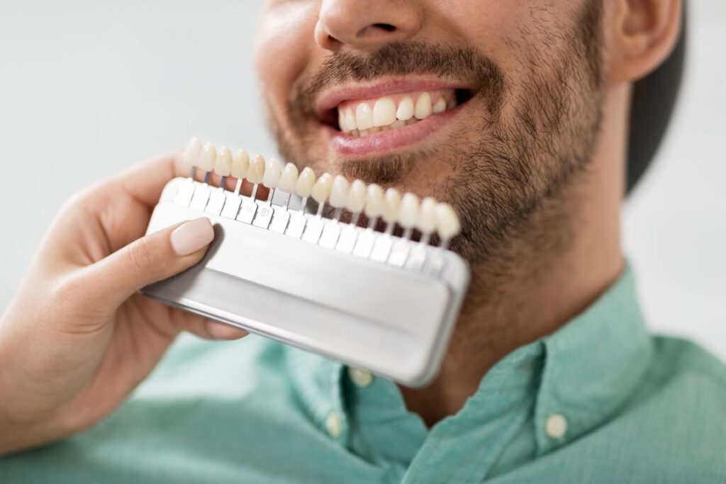 A man selecting a shade of porcelain veneers