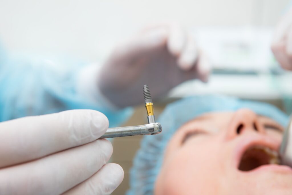 Closeup of dental implant post before it's inserted during surgery